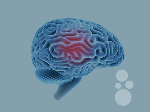 HOBT Treat Old Breain Injury At Charlottesville Hyperbarics